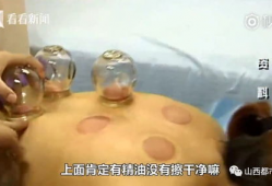 拔罐视频,揭秘拔罐神奇疗效的瞬间